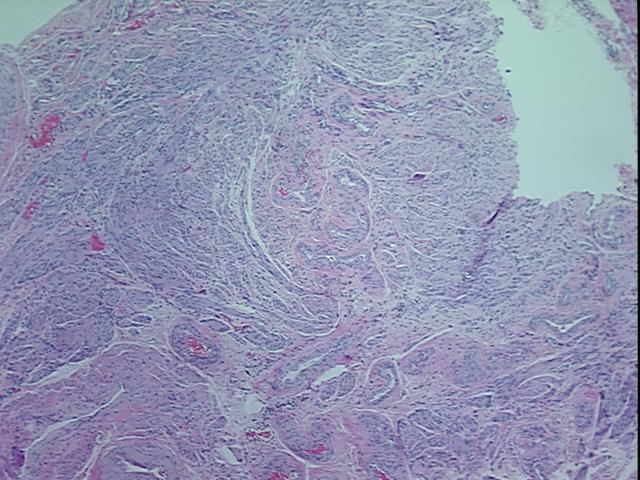 4x Image
