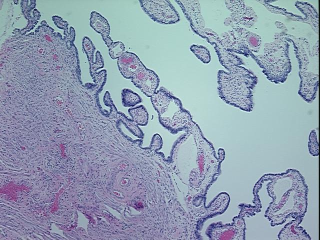 4x Image