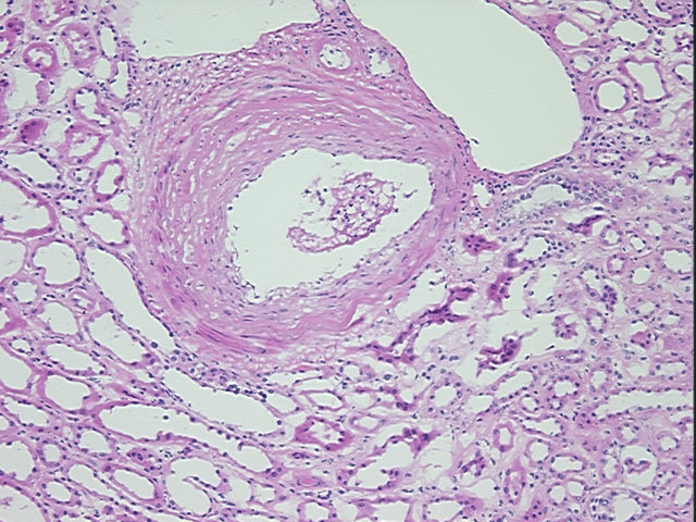 4x Image