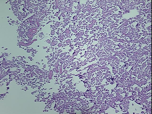 4x Image