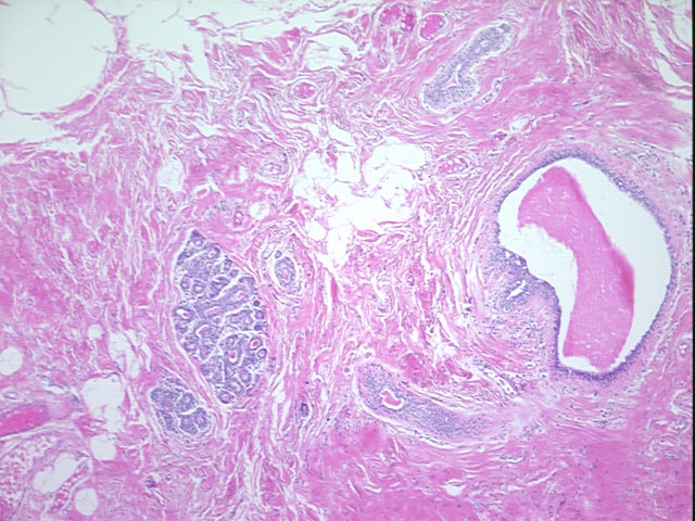 4x Image
