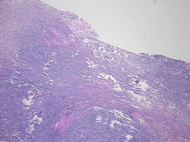 4x Image