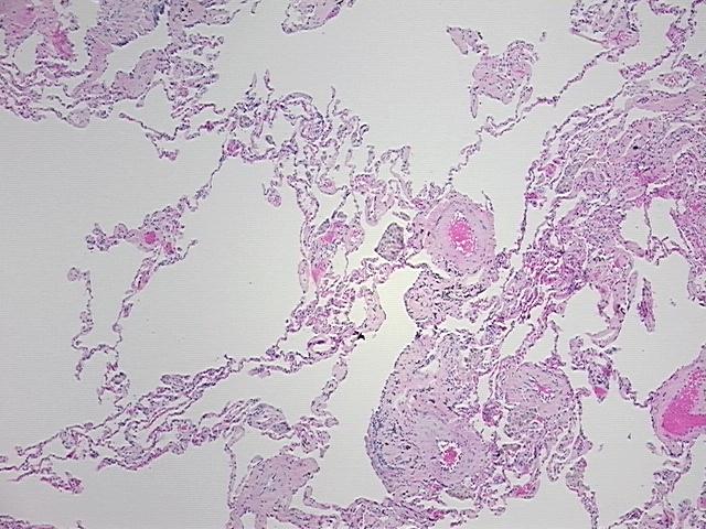 4x Image