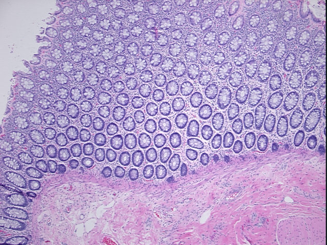 4x Image