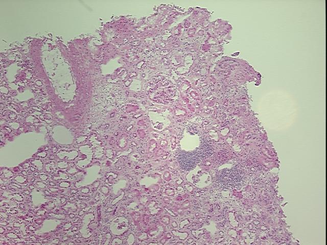 4x Image