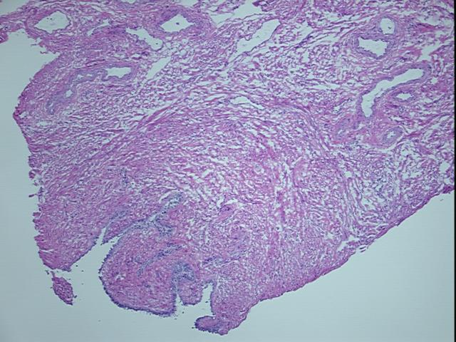 4x Image