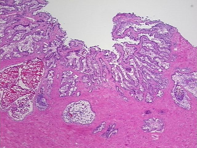 4x Image