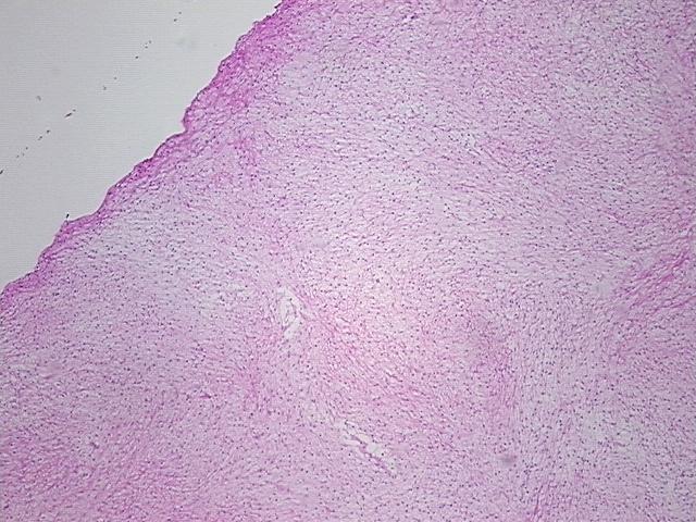 4x Image