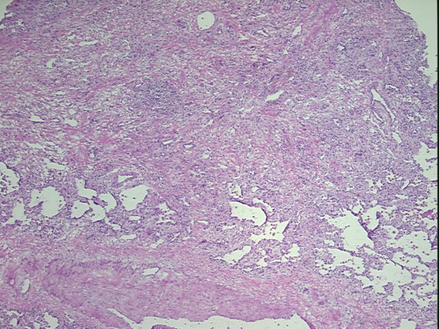 4x Image
