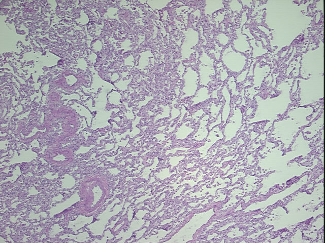 4x Image