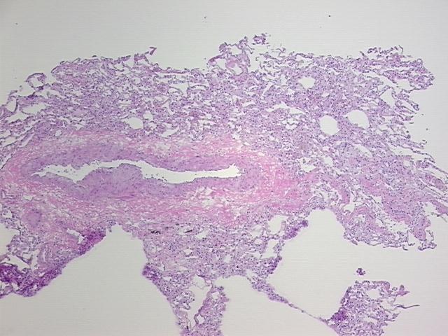 4x Image