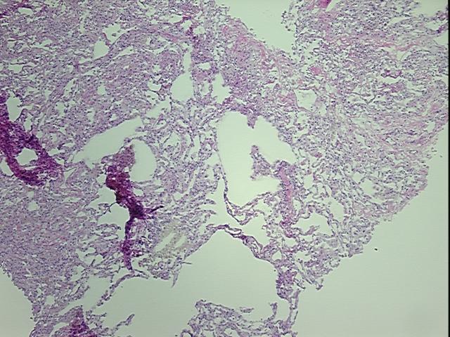 4x Image