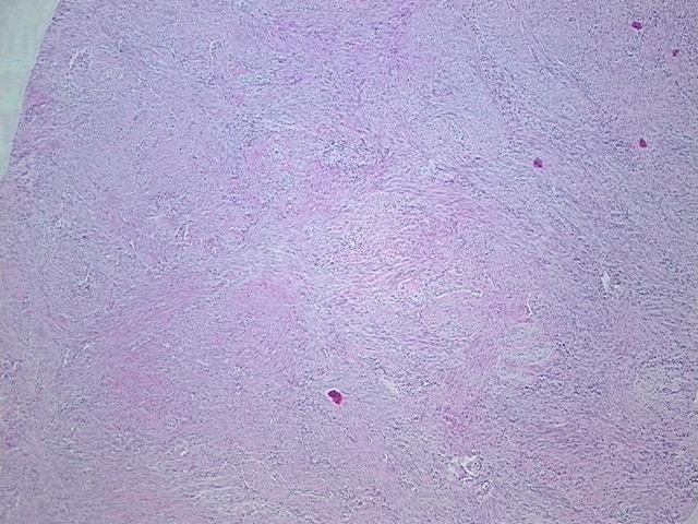 4x Image