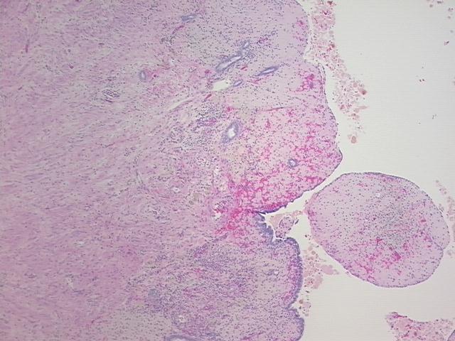 4x Image
