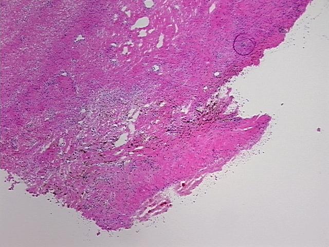 4x Image