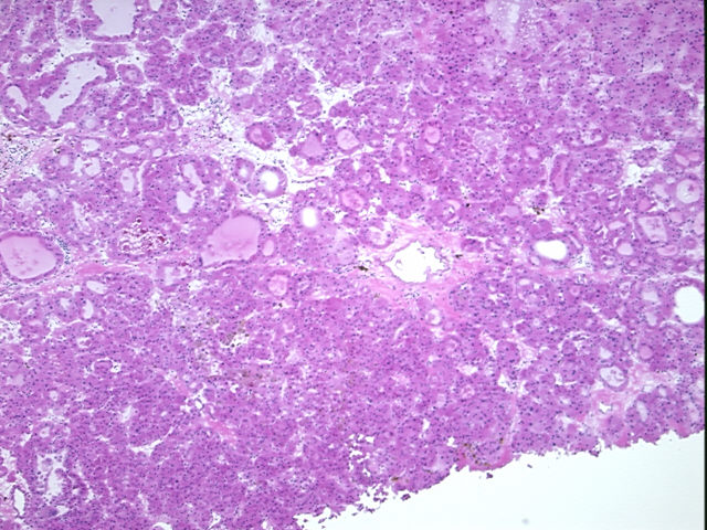 4x Image