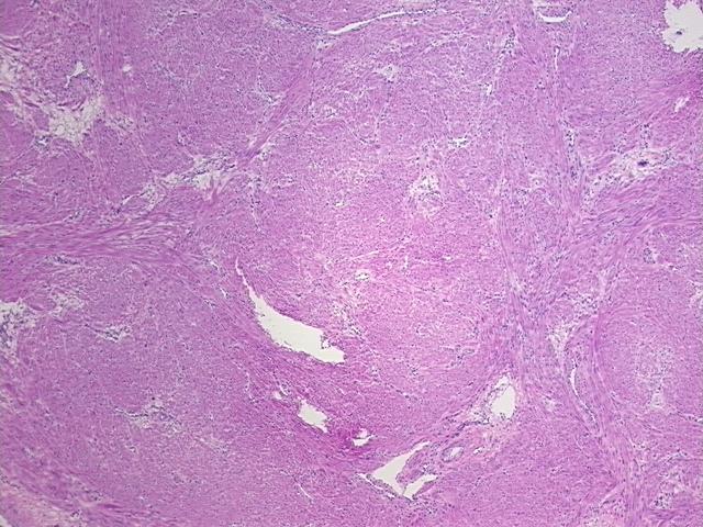 Frozen Tissue Sections, Myometrium