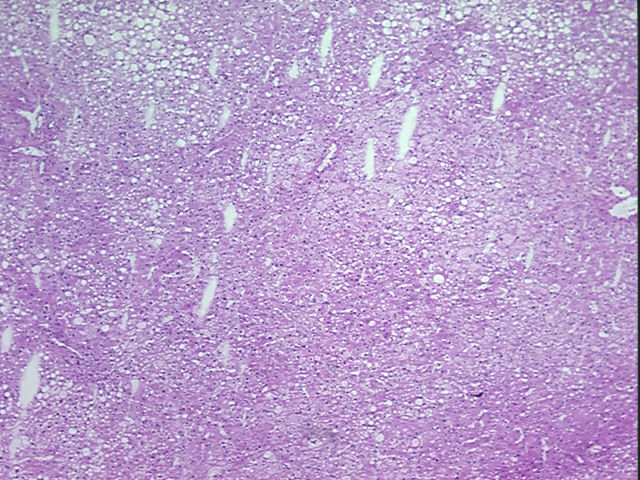 4x Image