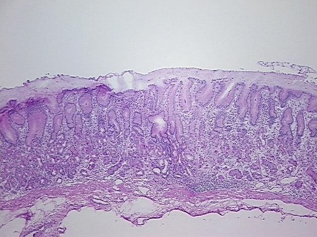 4x Image