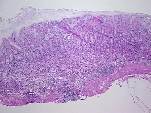 4x Image