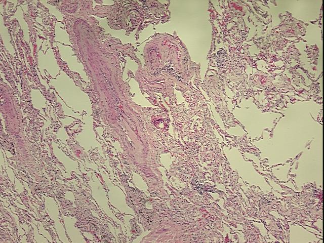 4x Image