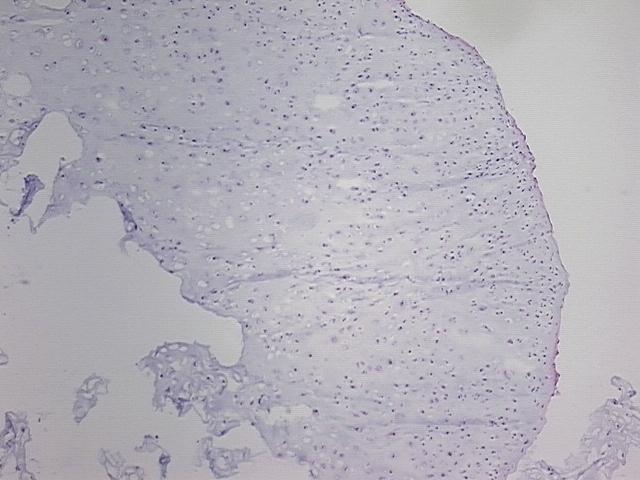 4x Image
