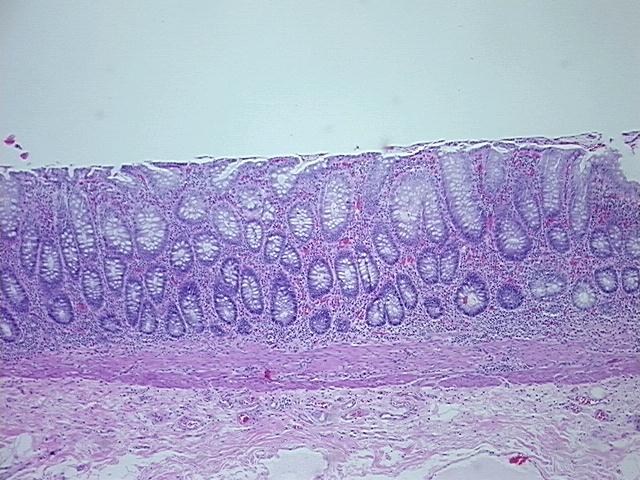 4x Image