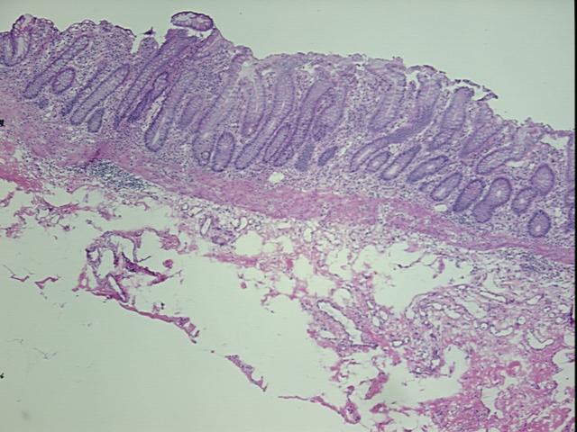 4x Image