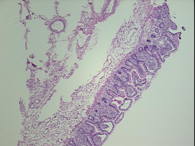 4x Image