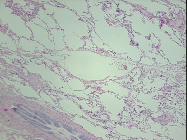 4x Image