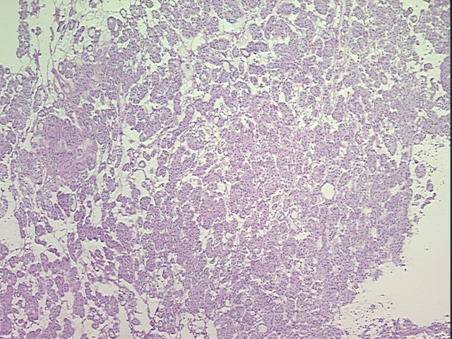 4x Image
