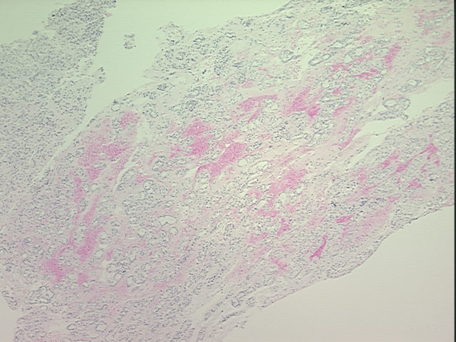 4x Image