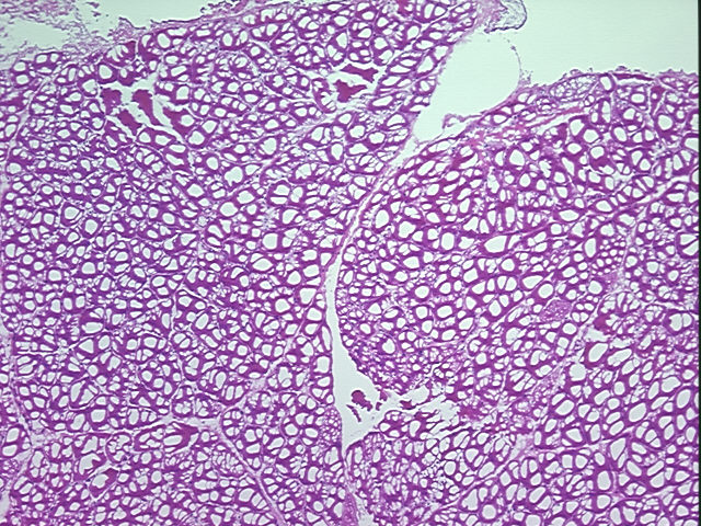 4x Image