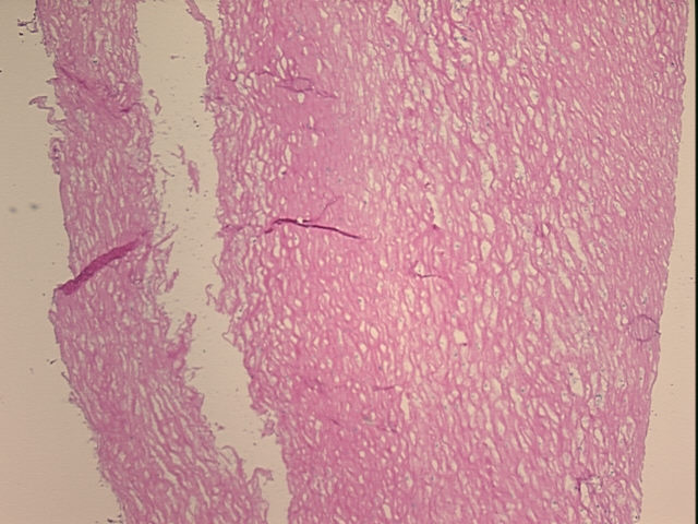 4x Image