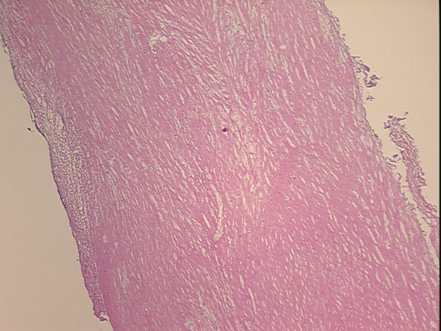 4x Image