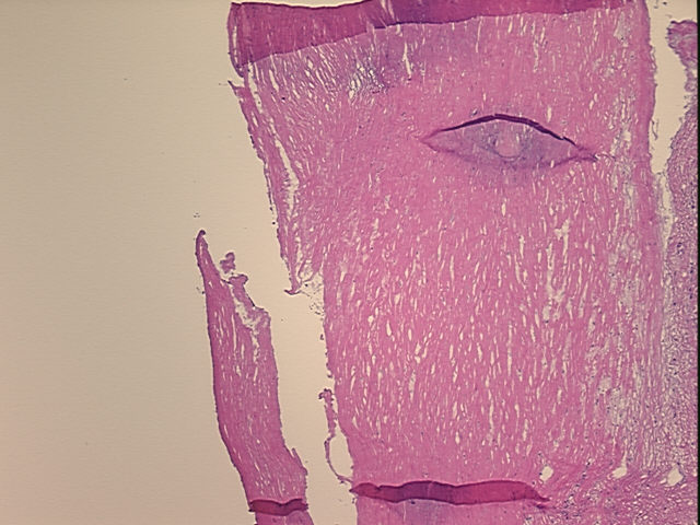4x Image