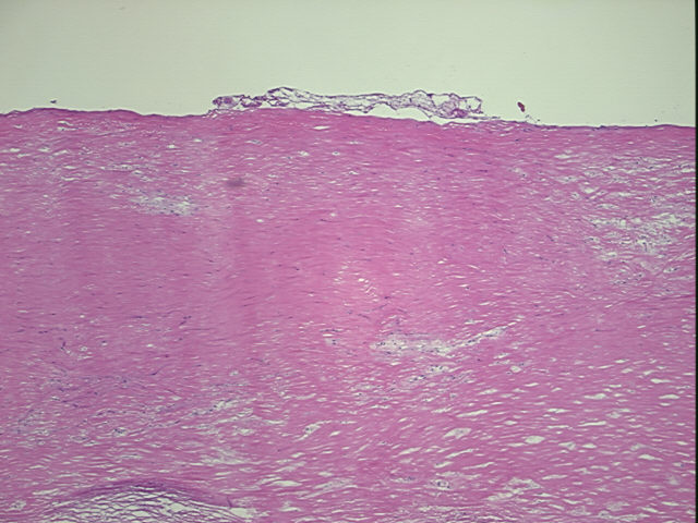 4x Image