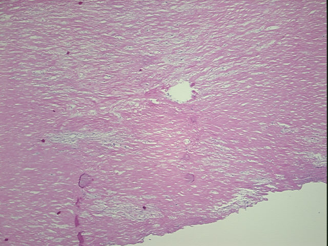4x Image
