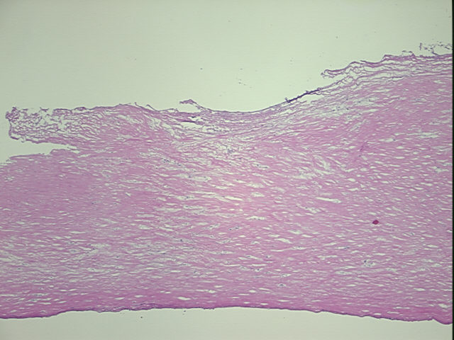 4x Image