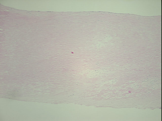 4x Image
