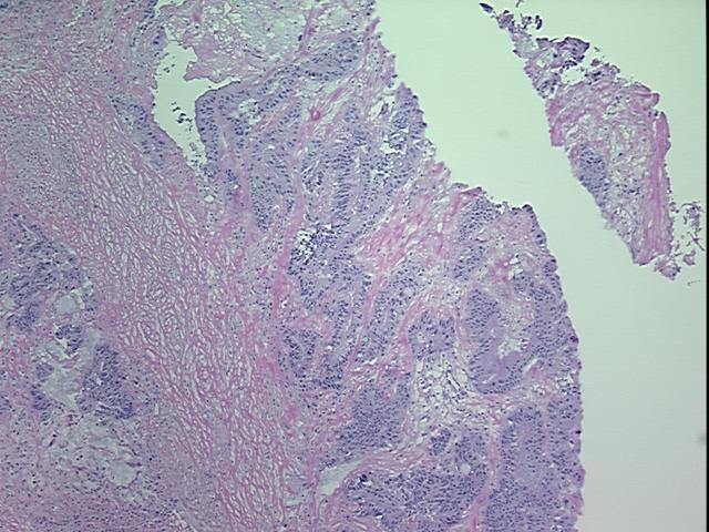 4x Image