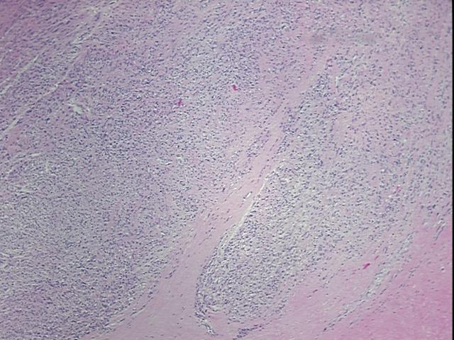 4x Image