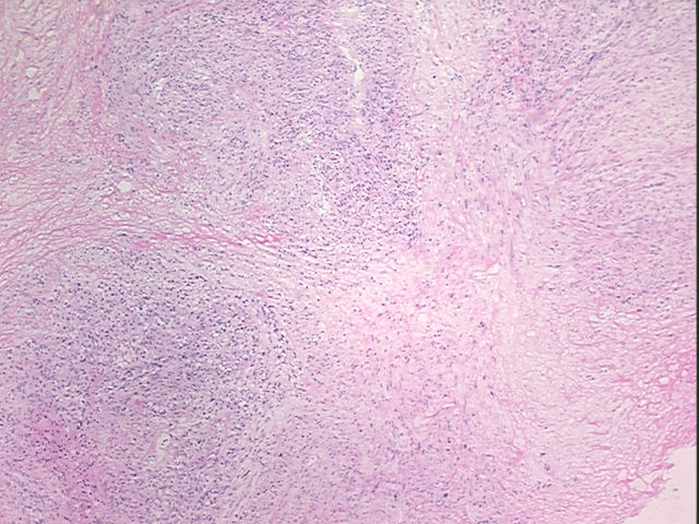 4x Image