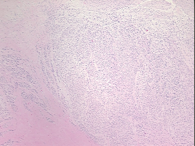 4x Image