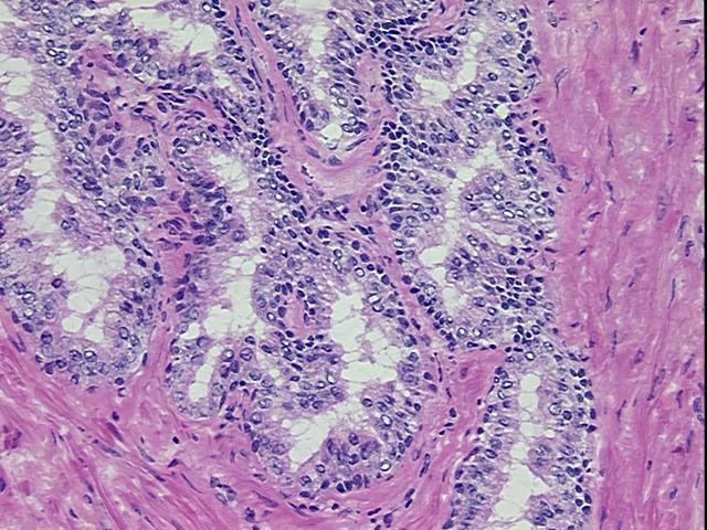 Tissue Sections (5x5um), Frozen; Prostate; Within normal