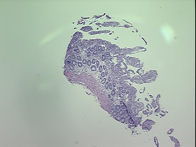 Frozen Tissue Sections, Duodenum | OriGene Technologies Inc.