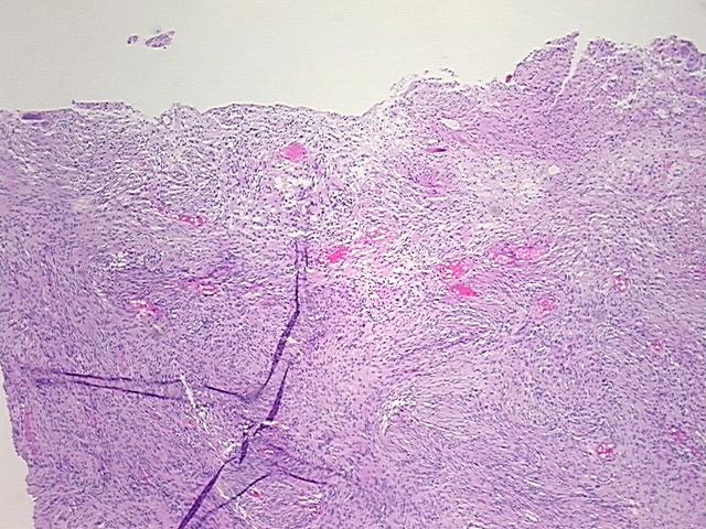 4x Image