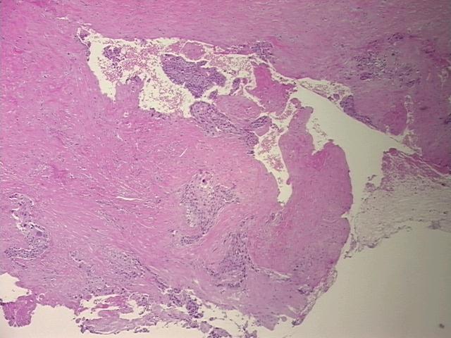 4x Image