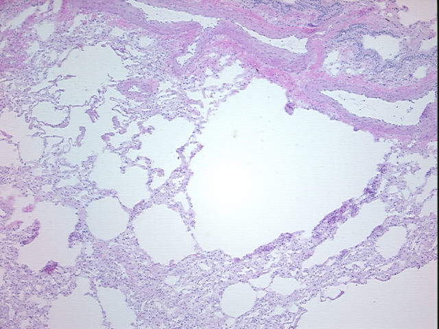 4x Image