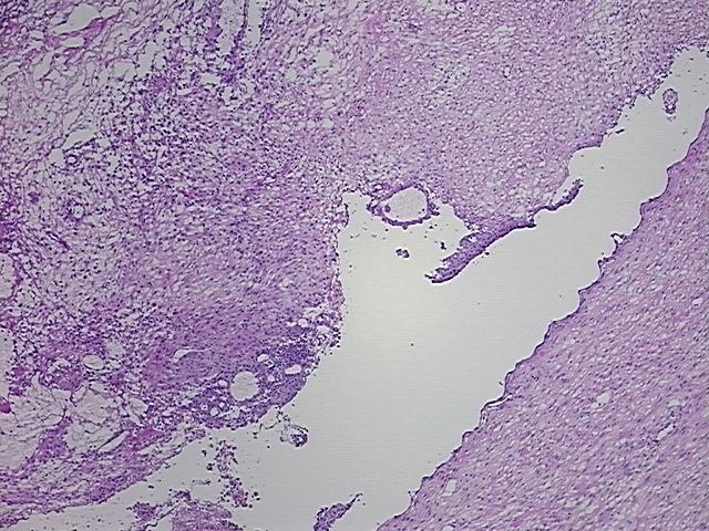 4x Image